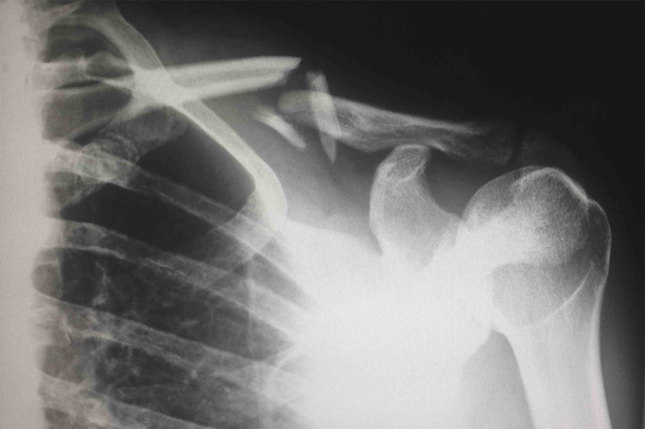 Silver State Orthopedics
